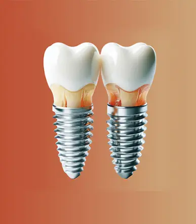 Ceramic layering 